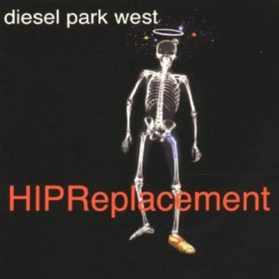 Diesel Park West - HIP Replacement